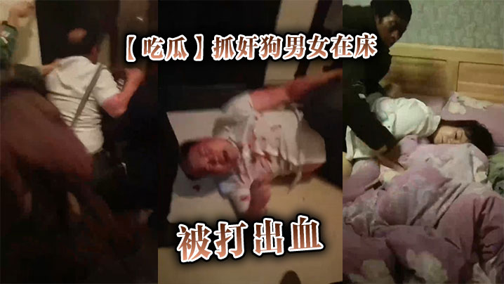 
【吃瓜】抓奸狗男女在床，被打出血