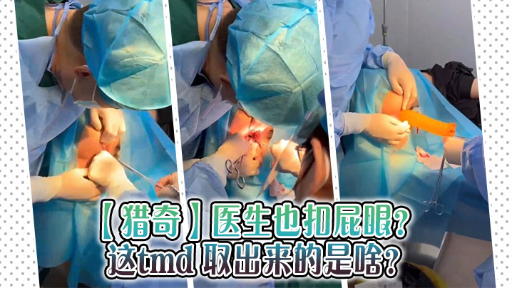 
【猎奇】医生也扣屁眼？ 这tmd 取出来的是啥？